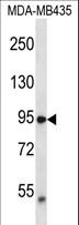 VRL1 / TRPV2 Antibody - TRPV2 Antibody western blot of MDA-MB435 cell line lysates (35 ug/lane). The TRPV2 antibody detected the TRPV2 protein (arrow).