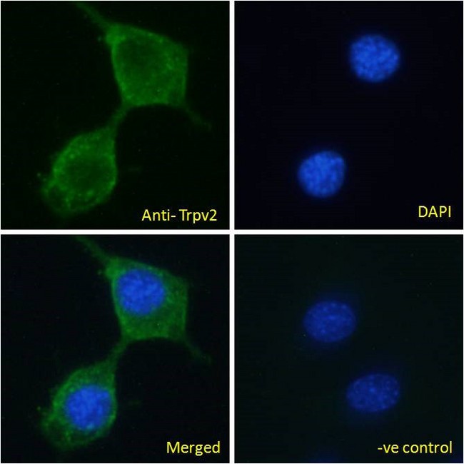 VRL1 / TRPV2 Antibody - Trpv2 (mouse) Antibody Immunofluorescence analysis of paraformaldehyde fixed NIH3T3 cells, permeabilized with 0.15% Triton. Primary incubation 1hr (10ug/ml) followed by Alexa Fluor 488 secondary antibody (2ug/ml), showing plasma membrane and cytoplasmic staining. The nuclear stain is DAPI (blue). Negative control: Unimmunized goat IgG (10ug/ml) followed by Alexa Fluor 488 secondary antibody (2ug/ml).