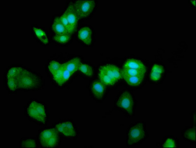 VRL1 / TRPV2 Antibody - Immunofluorescence staining of HepG2 cells at a dilution of 1:266, counter-stained with DAPI. The cells were fixed in 4% formaldehyde, permeabilized using 0.2% Triton X-100 and blocked in 10% normal Goat Serum. The cells were then incubated with the antibody overnight at 4 °C.The secondary antibody was Alexa Fluor 488-congugated AffiniPure Goat Anti-Rabbit IgG (H+L) .