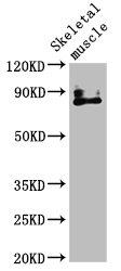 VRL1 / TRPV2 Antibody - Positive Western Blot detected in Mouse skeletal muscle tissue. All lanes: TRPV2 antibody at 4.51 µg/ml Secondary Goat polyclonal to rabbit IgG at 1/50000 dilution. Predicted band size: 86 KDa. Observed band size: 86 KDa