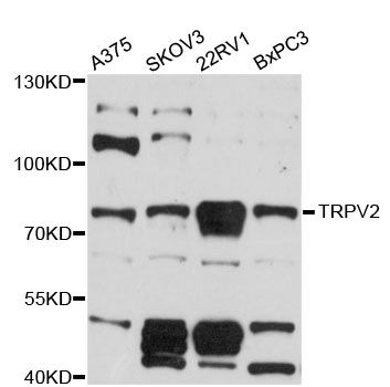 VRL1 / TRPV2 Antibody - Western blot analysis of extracts of various cell lines, using TRPV2 antibody at 1:3000 dilution. The secondary antibody used was an HRP Goat Anti-Rabbit IgG (H+L) at 1:10000 dilution. Lysates were loaded 25ug per lane and 3% nonfat dry milk in TBST was used for blocking. An ECL Kit was used for detection and the exposure time was 60s.