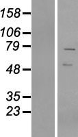 VRTN Protein - Western validation with an anti-DDK antibody * L: Control HEK293 lysate R: Over-expression lysate