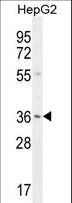 VSIG1 Antibody - VSIG1 Antibody western blot of HepG2 cell line lysates (35 ug/lane). The VSIG1 antibody detected the VSIG1 protein (arrow).