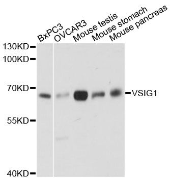 VSIG1 Antibody - Western blot analysis of extracts of various cell lines, using VSIG1 antibody at 1:3000 dilution. The secondary antibody used was an HRP Goat Anti-Rabbit IgG (H+L) at 1:10000 dilution. Lysates were loaded 25ug per lane and 3% nonfat dry milk in TBST was used for blocking. An ECL Kit was used for detection and the exposure time was 10s.