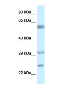 VSIG10 Antibody - VSIG10 / FLJ20674 antibody Western blot of 1 Cell lysate. Antibody concentration 1 ug/ml. This image was taken for the unconjugated form of this product. Other forms have not been tested.