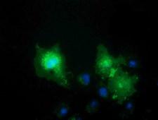 VSIG2 Antibody - Anti-VSIG2 mouse monoclonal antibody immunofluorescent staining of COS7 cells transiently transfected by pCMV6-ENTRY VSIG2.