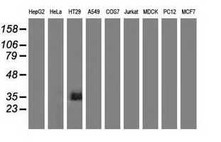 VSIG2 Antibody - Western blot of extracts (35 ug) from 9 different cell lines by using anti-VSIG2 monoclonal antibody.