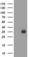 VSIG2 Antibody - HEK293T cells were transfected with the pCMV6-ENTRY control (Left lane) or pCMV6-ENTRY VSIG2 (Right lane) cDNA for 48 hrs and lysed. Equivalent amounts of cell lysates (5 ug per lane) were separated by SDS-PAGE and immunoblotted with anti-VSIG2.