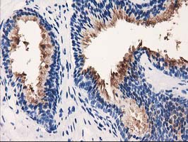 VSIG2 Antibody - IHC of paraffin-embedded Human prostate tissue using anti-VSIG2 mouse monoclonal antibody. (Heat-induced epitope retrieval by 10mM citric buffer, pH6.0, 100C for 10min).