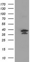 VSIG2 Antibody - HEK293T cells were transfected with the pCMV6-ENTRY control (Left lane) or pCMV6-ENTRY VSIG2 (Right lane) cDNA for 48 hrs and lysed. Equivalent amounts of cell lysates (5 ug per lane) were separated by SDS-PAGE and immunoblotted with anti-VSIG2.