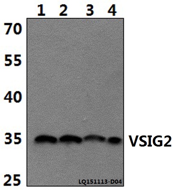 VSIG2 Antibody - Western blot of VSIG2 polyclonal antibody at 1:500 dilution. Lane 1: DLD whole cell lysate (40 ug). Lane 2: The Stomach tissue lysate of Rat(30 ug). Lane 3: The Stomach tissue lysate of Mouse(30 ug). Lane 4: PC3 whole cell lysate (40 ug).
