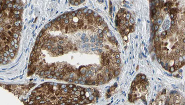 VSIG2 Antibody - 1:100 staining human prostate tissue by IHC-P. The sample was formaldehyde fixed and a heat mediated antigen retrieval step in citrate buffer was performed. The sample was then blocked and incubated with the antibody for 1.5 hours at 22°C. An HRP conjugated goat anti-rabbit antibody was used as the secondary.