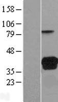 VSIG2 Protein - Western validation with an anti-DDK antibody * L: Control HEK293 lysate R: Over-expression lysate