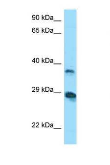 VSIG4 Antibody - VSIG4 antibody Western blot of COL0205 Cell lysate. Antibody concentration 1 ug/ml.  This image was taken for the unconjugated form of this product. Other forms have not been tested.