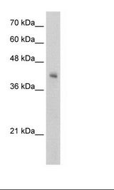 VSIG4 Antibody - Jurkat Cell Lysate.  This image was taken for the unconjugated form of this product. Other forms have not been tested.
