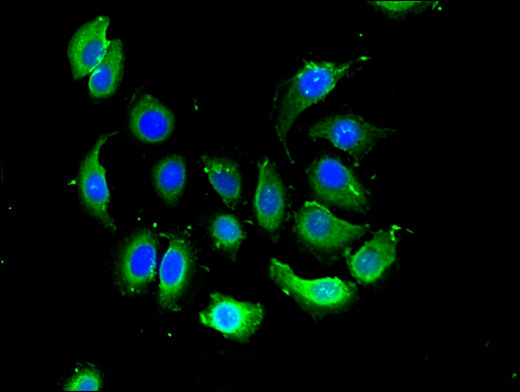 VSIG4 Antibody - Immunofluorescent analysis of A549 cells using VSIG4 Antibody at a dilution of 1:100 and Alexa Fluor 488-congugated AffiniPure Goat Anti-Rabbit IgG(H+L)