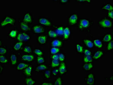VSIG8 Antibody - Immunofluorescence staining of Hela cells with VSIG8 Antibody at 1:133, counter-stained with DAPI. The cells were fixed in 4% formaldehyde, permeabilized using 0.2% Triton X-100 and blocked in 10% normal Goat Serum. The cells were then incubated with the antibody overnight at 4°C. The secondary antibody was Alexa Fluor 488-congugated AffiniPure Goat Anti-Rabbit IgG(H+L).