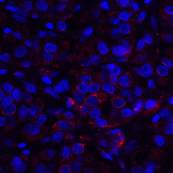 VSIR / GI24 / VISTA Antibody - Immunofluorescence of VISTA in human lymphoma tissue with VISTA antibody at 10 ug/mL. Red: VISTA Antibody [6D2] Blue: DAPI staining