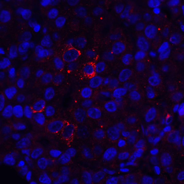 VSIR / GI24 / VISTA Antibody - Immunofluorescence of VISTA in human lymphoma tissue with VISTA antibody at 10 ug/mL. Red: VISTA Antibody [9E4] Blue: DAPI staining