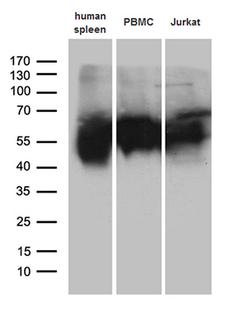 VSIR / GI24 / VISTA Antibody - Western blot analysis of extracts. (35ug) from 3 cell lines and human spleen tissue lysate by using anti-C10orf54 monoclonal antibody. (1:500)