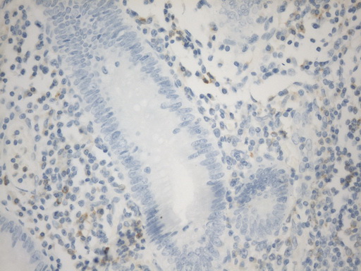 VSIR / GI24 / VISTA Antibody - Immunohistochemical staining of paraffin-embedded Human appendix tissue within the normal limits using anti-VISTA(C10ORF54) mouse monoclonal antibody. (Heat-induced epitope retrieval by 1mM EDTA in 10mM Tris buffer. (pH8.0) at 120°C for 2.5 min. (1:50)