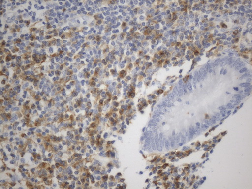 VSIR / GI24 / VISTA Antibody - Immunohistochemical staining of paraffin-embedded Human appendix tissue within the normal limits using anti-VISTA(C10ORF54) mouse monoclonal antibody. (Heat-induced epitope retrieval by 1mM EDTA in 10mM Tris buffer. (pH8.0) at 120°C for 2.5 min. (1:200)