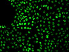 VSIR / GI24 / VISTA Antibody - Immunofluorescence staining of VISTA in A431 cells. Cells were fixed with 4% PFA, permeabilzed with 0.1% Triton X-100 in PBS, blocked with 10% serum, and incubated with rabbit anti-Human VISTA polyclonal antibody (dilution ratio 1:200) at 4°C overnight. Then cells were stained with the Alexa Fluor 488-conjugated Goat Anti-rabbit IgG secondary antibody (green). Positive staining was localized to Nucleus.
