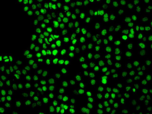 VSIR / GI24 / VISTA Antibody - Immunofluorescence staining of VISTA in A431 cells. Cells were fixed with 4% PFA, permeabilzed with 0.1% Triton X-100 in PBS, blocked with 10% serum, and incubated with rabbit anti-Human VISTA polyclonal antibody (dilution ratio 1:200) at 4°C overnight. Then cells were stained with the Alexa Fluor 488-conjugated Goat Anti-rabbit IgG secondary antibody (green). Positive staining was localized to Nucleus.