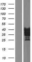 VSTM1 Protein - Western validation with an anti-DDK antibody * L: Control HEK293 lysate R: Over-expression lysate
