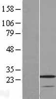 VSTM2A Protein - Western validation with an anti-DDK antibody * L: Control HEK293 lysate R: Over-expression lysate