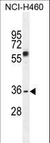 VSTM4 Antibody - C10orf72 Antibody western blot of NCI-H460 cell line lysates (35 ug/lane). The C10orf72 antibody detected the C10orf72 protein (arrow).