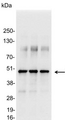 VSV-g Tag Antibody - Detection of VSV-G-tagged fusion protein in 200, 100, and 50ng of E. coli lysate
