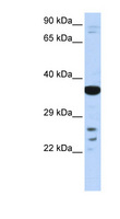 VSX1 Antibody - VSX1 antibody Western blot of Fetal liver lysate. This image was taken for the unconjugated form of this product. Other forms have not been tested.