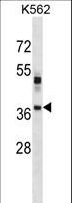 VSX1 Antibody - VSX1 Antibody western blot of K562 cell line lysates (35 ug/lane). The VSX1 antibody detected the VSX1 protein (arrow).