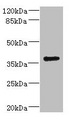 VSX1 Antibody - Western blot All Lanes: VSX1 antibody IgG at 2.32ug/ml+ 293T whole cell lysate Secondary Goat polyclonal to rabbit IgG at 1/10000 dilution Predicted band size: 39,25,40,15,30,23,25,33 kDa Observed band size: 38 kDa