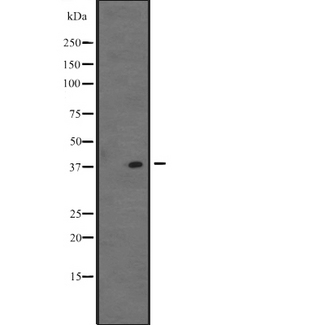 VSX1 Antibody - Western blot analysis of VSX1 expression in K562 cells line lysate. The lane on the left is treated with the antigen-specific peptide.