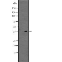 VSX1 Antibody - Western blot analysis of VSX1 expression in K562 cells line lysate. The lane on the left is treated with the antigen-specific peptide.
