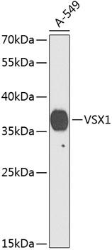 VSX1 Antibody - Western blot analysis of extracts of A-549 cells using VSX1 Polyclonal Antibody at dilution of 1:1000.