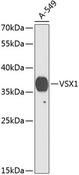 VSX1 Antibody - Western blot analysis of extracts of A-549 cells using VSX1 Polyclonal Antibody at dilution of 1:1000.