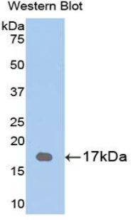 VSX2 / CHX10 Antibody - Western blot of recombinant VSX2 / CHX10.  This image was taken for the unconjugated form of this product. Other forms have not been tested.