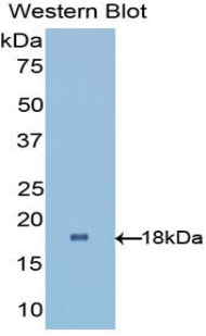 VSX2 / CHX10 Antibody - Western blot of recombinant VSX2 / CHX10.  This image was taken for the unconjugated form of this product. Other forms have not been tested.