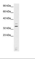 VSX2 / CHX10 Antibody - Jurkat Cell Lysate.  This image was taken for the unconjugated form of this product. Other forms have not been tested.