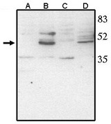 VSX2 / CHX10 Antibody - Western blot of anti-Chk10 (CT) antibody at 1 ug/ml on rat liver (A), retina tissue lysate (B), mouse liver (C) and retina (D) tissue lysate.