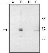 VSX2 / CHX10 Antibody - Western blot of anti-Chx10 (NT) antibody at 1 ug/ml on rat liver (A), retina tissue lysate (B), mouse liver (C) and retina (D) tissue lysate.