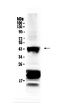 VSX2 / CHX10 Antibody - Western blot analysis of CHX10 using anti-CHX10 antibody. Electrophoresis was performed on a 5-20% SDS-PAGE gel at 70V (Stacking gel) / 90V (Resolving gel) for 2-3 hours. The sample well of each lane was loaded with 50ug of sample under reducing conditions. Lane 1: mouse eye ball tissue lysate. After Electrophoresis, proteins were transferred to a Nitrocellulose membrane at 150mA for 50-90 minutes. Blocked the membrane with 5% Non-fat Milk/ TBS for 1.5 hour at RT. The membrane was incubated with rabbit anti-CHX10 antigen affinity purified polyclonal antibody at 0.5 µg/mL overnight at 4°C, then washed with TBS-0.1% Tween 3 times with 5 minutes each and probed with a goat anti-rabbit IgG-HRP secondary antibody at a dilution of 1:10000 for 1.5 hour at RT. The signal is developed using an Enhanced Chemiluminescent detection (ECL) kit with Tanon 5200 system. A specific band was detected for CHX10 at approximately 43KD. The expected band size for CHX10 is at 39KD.