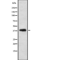 VSX2 / CHX10 Antibody - Western blot analysis of VSX2 using NIH-3T3 whole cells lysates