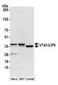 VTA1 Antibody - Detection of human VTA1/LIP5 by western blot. Samples: Whole cell lysate (50 µg) from HeLa, HEK293T, and Jurkat cells prepared using NETN lysis buffer. Antibody: Affinity purified rabbit anti-VTA1/LIP5 antibody used for WB at 0.1 µg/ml. Detection: Chemiluminescence with an exposure time of 3 minutes.