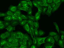 VTA1 Antibody - Immunofluorescence staining of VTA1 in U2OS cells. Cells were fixed with 4% PFA, permeabilzed with 0.1% Triton X-100 in PBS, blocked with 10% serum, and incubated with rabbit anti-human VTA1 polyclonal antibody (dilution ratio 1:500) at 4°C overnight. Then cells were stained with the Alexa Fluor 488-conjugated Goat Anti-rabbit IgG secondary antibody (green). Positive staining was localized to Cytoplasm.