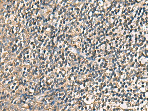 VTA1 Antibody - Immunohistochemistry of paraffin-embedded Human tonsil tissue  using VTA1 Polyclonal Antibody at dilution of 1:85(×200)