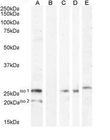 VTCN1 / B7-H4 Antibody - Goat Anti-B7-H4 Antibody (1ug/ml) staining of HEK293 iso 1 + iso 2 cell lysate (A) + peptide (B). Human Adrenal Gland iso 1 (C), Human Adrenal Gland iso 2 (D) and (0.1µg/ml) Human pancreas iso 1 (E) lysate (35µg protein in RIPA buffer). Detected by chemiluminescencence.
